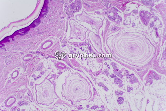 Peau du doigt avec corpuscules de Pacini x10 - gryphea.com